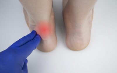 Achilles tendon tendinitis