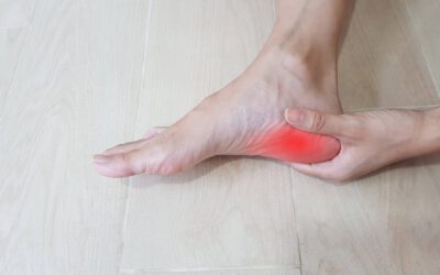 Understanding Recovery Time for Plantar Fasciitis